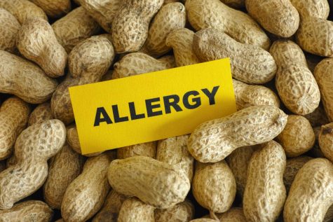 Nut allergies make me anxious